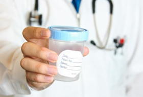 Is blood in your urine cause for concern? 